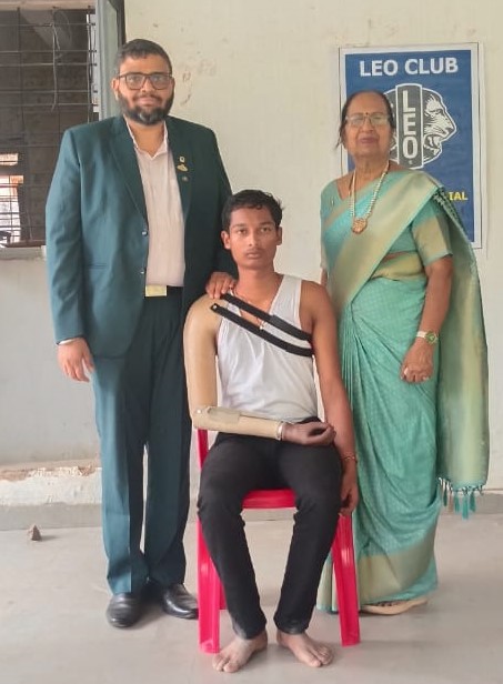 Gift of Mobility – Artificial Limb Donation